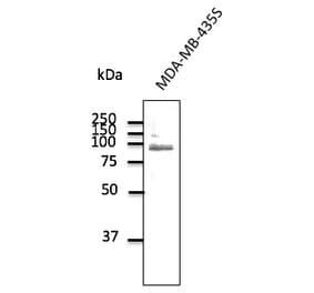 Western Blot - Anti-TLR2 Antibody (AB0098) - Antibodies.com