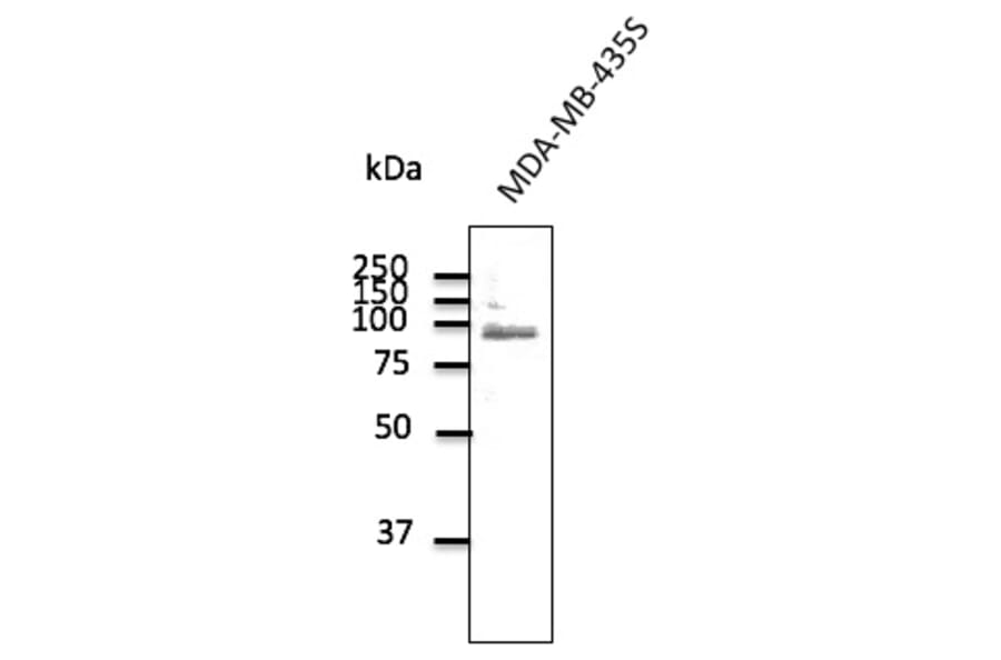 Western Blot - Anti-TLR2 Antibody (AB0098) - Antibodies.com