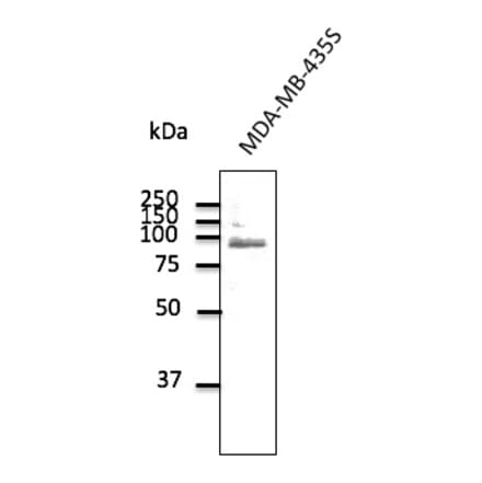 Western Blot - Anti-TLR2 Antibody (AB0098) - Antibodies.com