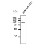 Western Blot - Anti-TLR2 Antibody (AB0098) - Antibodies.com