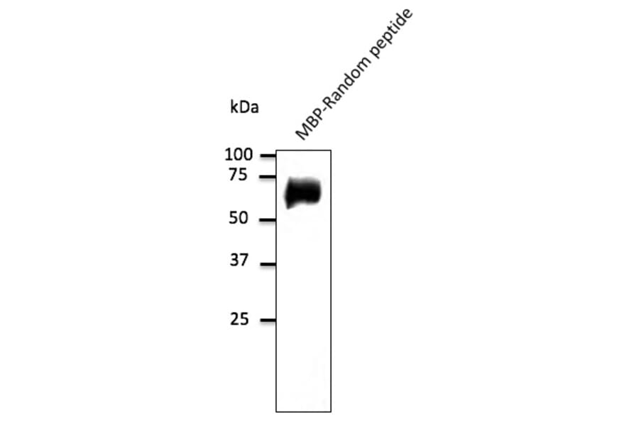 Western Blot - Anti-Random Protein Antibody (AB0099) - Antibodies.com