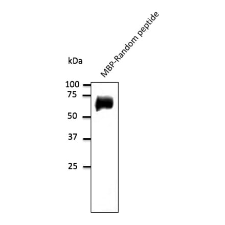 Western Blot - Anti-Random Protein Antibody (AB0099) - Antibodies.com