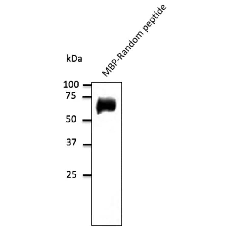 Western Blot - Anti-Random Protein Antibody (AB0099) - Antibodies.com