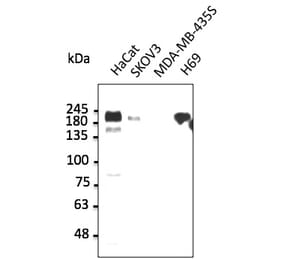 Western Blot - Anti-ERBB1 Antibody (AB0106) - Antibodies.com
