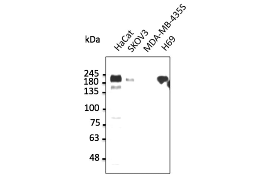 Western Blot - Anti-ERBB1 Antibody (AB0106) - Antibodies.com