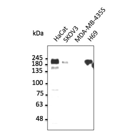 Western Blot - Anti-ERBB1 Antibody (AB0106) - Antibodies.com