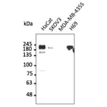 Western Blot - Anti-ERBB1 Antibody (AB0106) - Antibodies.com