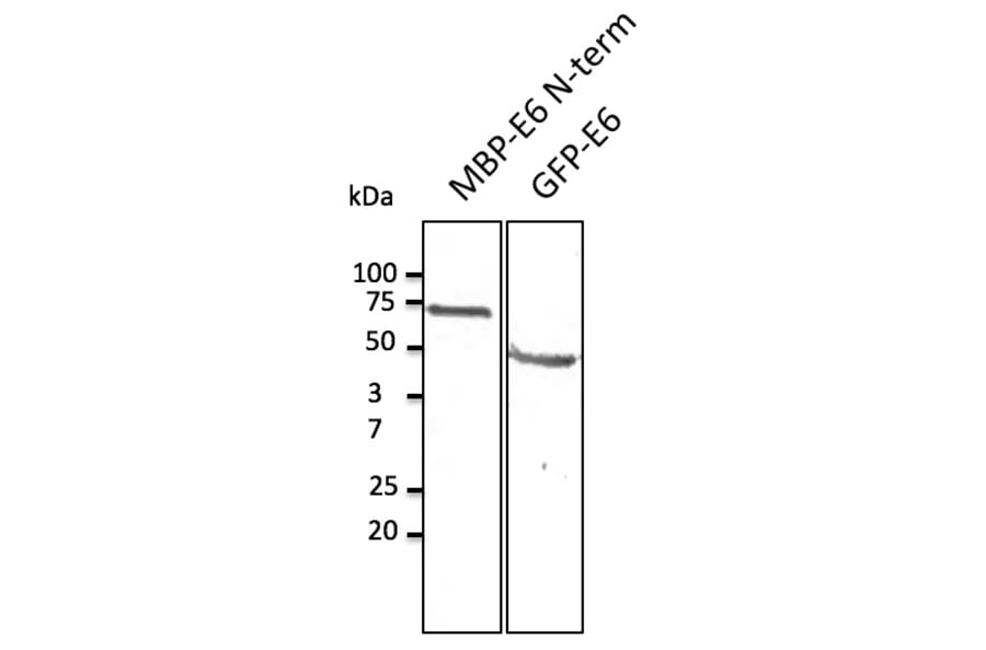 Western Blot - Anti-HPV11 E6 Antibody (AB0107) - Antibodies.com