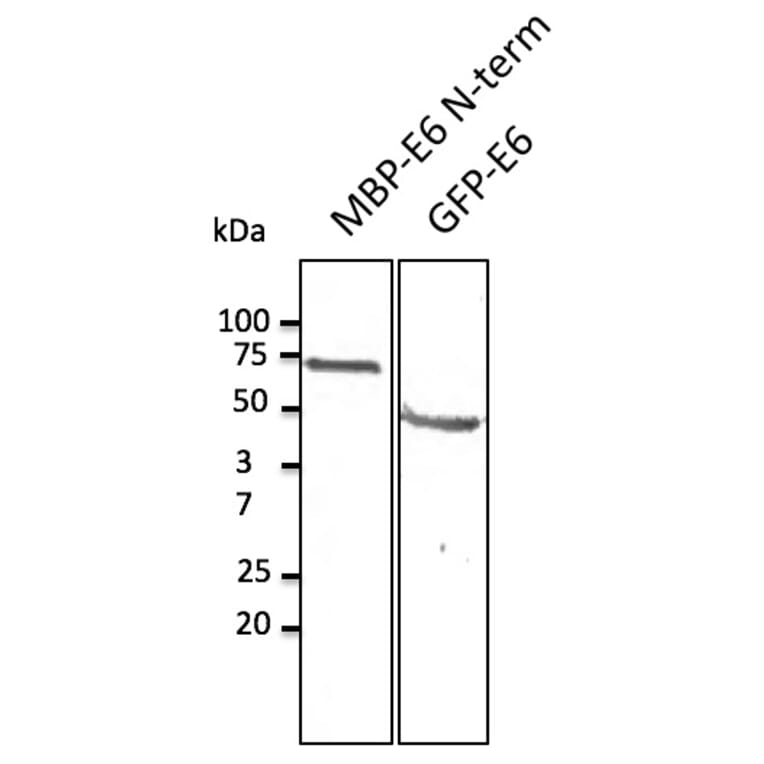 Western Blot - Anti-HPV11 E6 Antibody (AB0107) - Antibodies.com