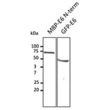 Western Blot - Anti-HPV11 E6 Antibody (AB0107) - Antibodies.com