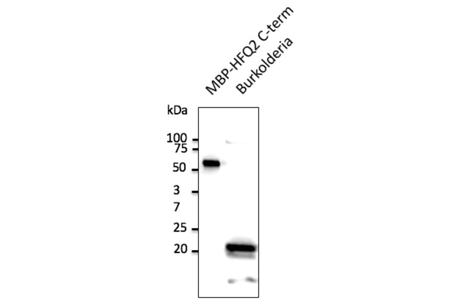 Western Blot - Anti-HFQ2 Antibody (A121619) - Antibodies.com
