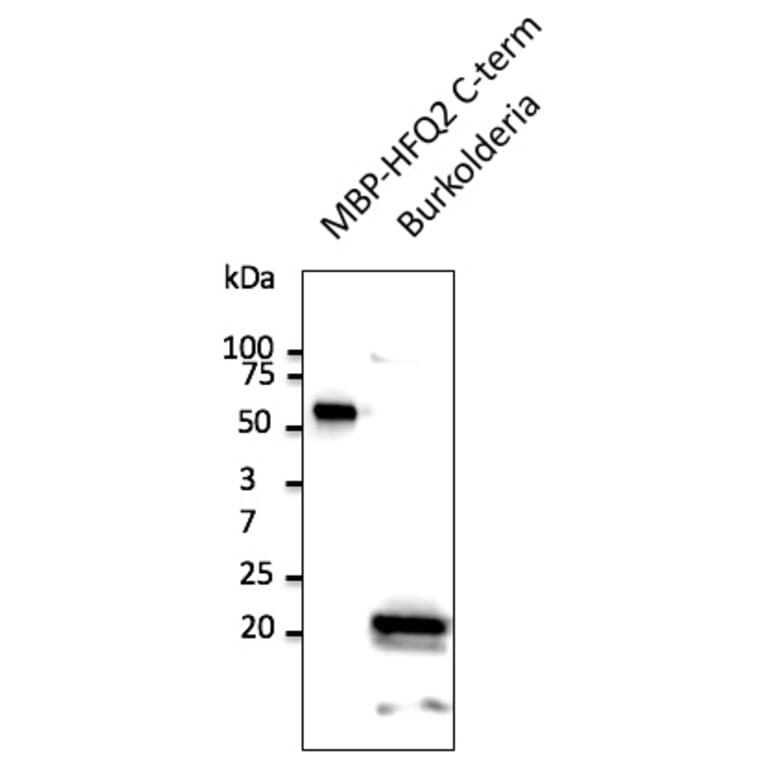 Western Blot - Anti-HFQ2 Antibody (A121619) - Antibodies.com