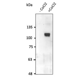 Western Blot - Anti-HIF-1 alpha Antibody (AB0112) - Antibodies.com