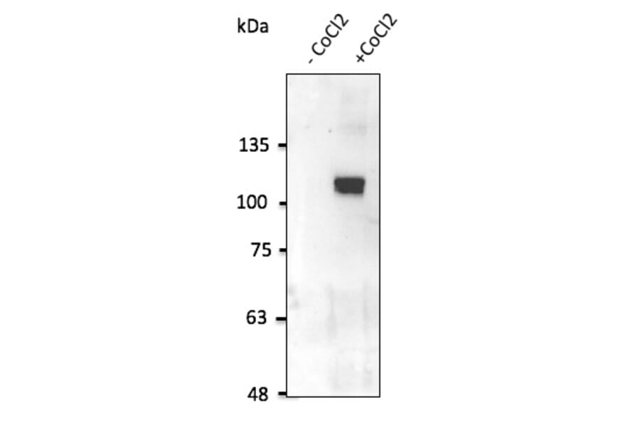 Western Blot - Anti-HIF-1 alpha Antibody (AB0112) - Antibodies.com