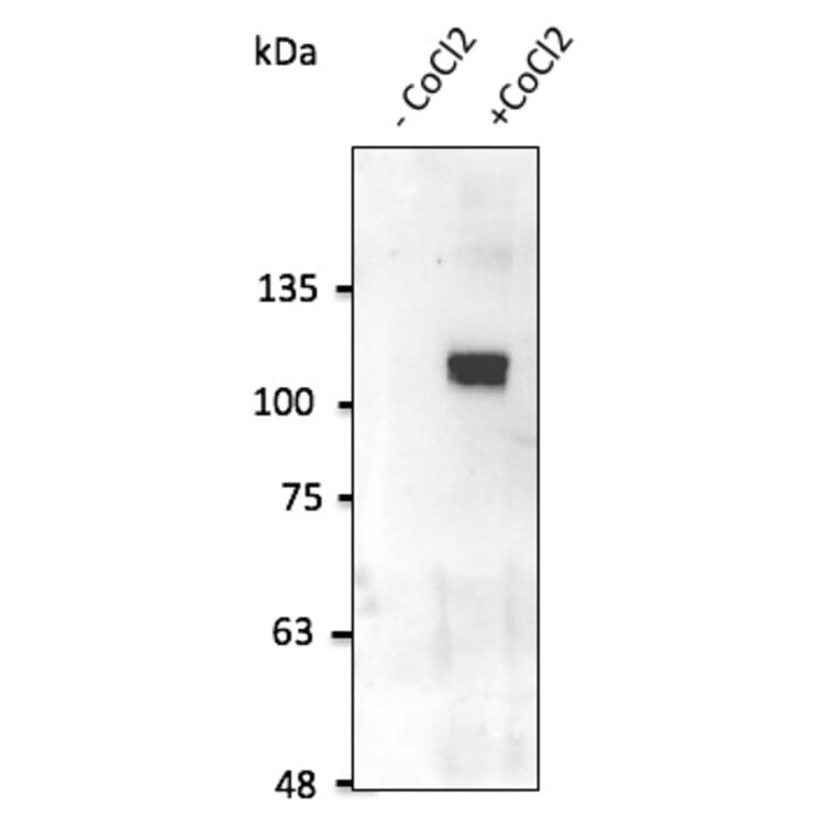 Western Blot - Anti-HIF-1 alpha Antibody (AB0112) - Antibodies.com