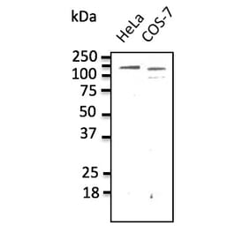 Western Blot - Anti-CDH1 Antibody (AB0115) - Antibodies.com