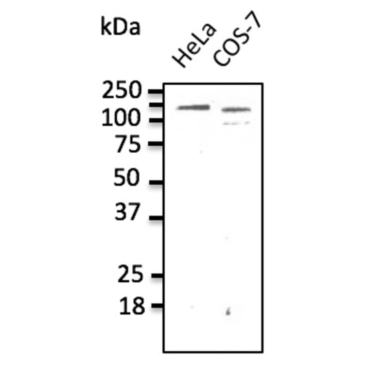 Western Blot - Anti-CDH1 Antibody (AB0115) - Antibodies.com