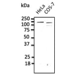 Western Blot - Anti-CDH1 Antibody (AB0115) - Antibodies.com