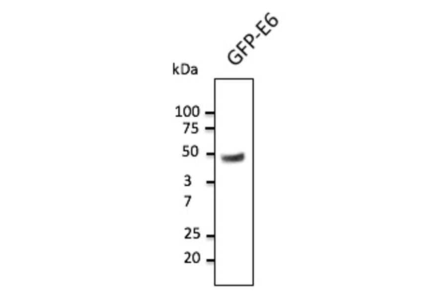 Western Blot - Anti-HPV11 E6 Antibody (AB0125) - Antibodies.com
