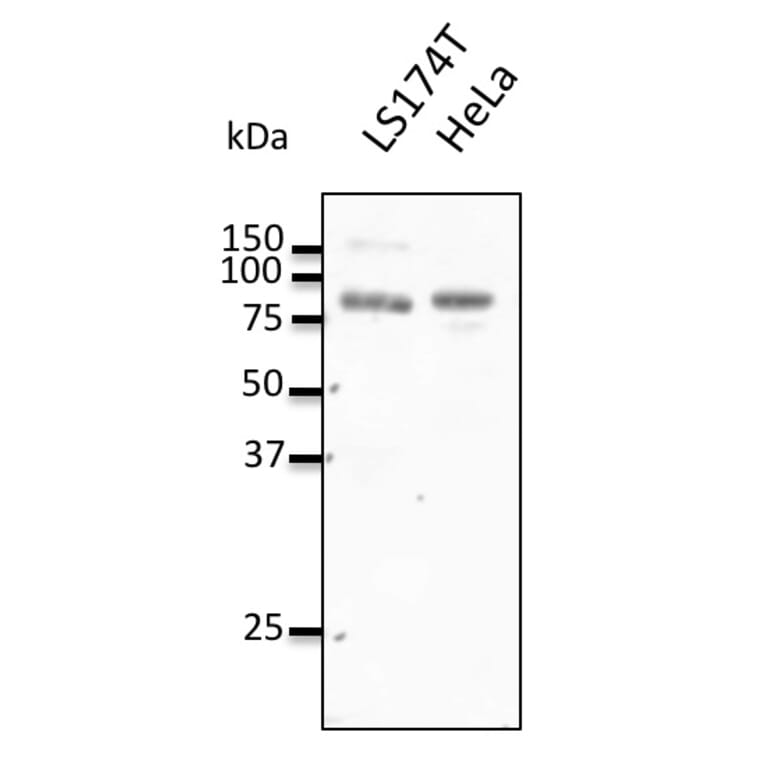 Western Blot - Anti-REP2 Antibody (AB0132) - Antibodies.com