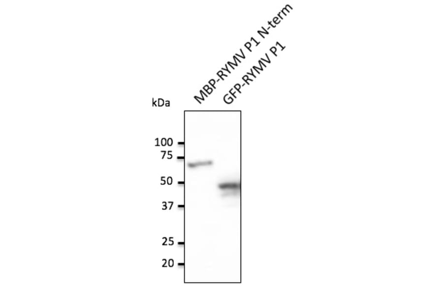 Western Blot - Anti-RYMV P1 Antibody (AB0146) - Antibodies.com