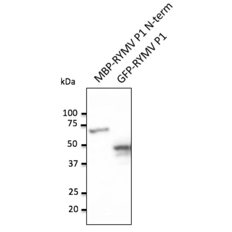 Western Blot - Anti-RYMV P1 Antibody (AB0146) - Antibodies.com