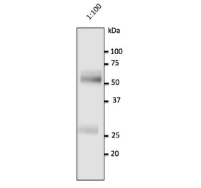 Western Blot - Anti-Human IgG Antibody (AB0147) - Antibodies.com