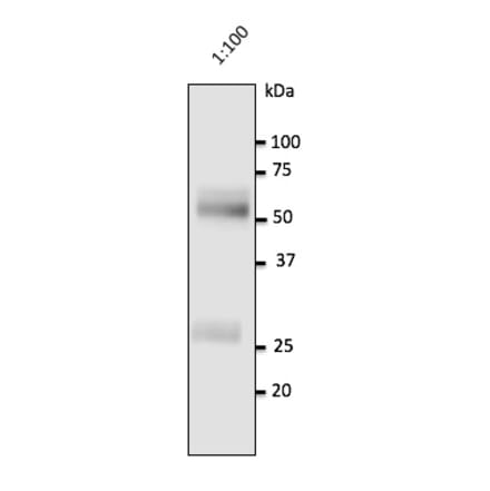 Western Blot - Anti-Human IgG Antibody (AB0147) - Antibodies.com