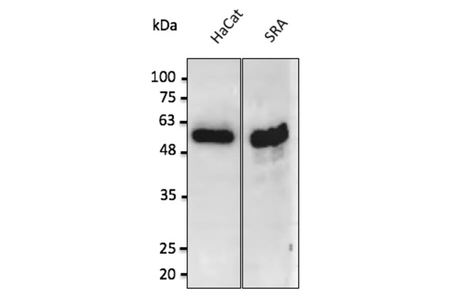 Western Blot - Anti-p53 Antibody (AB0154) - Antibodies.com