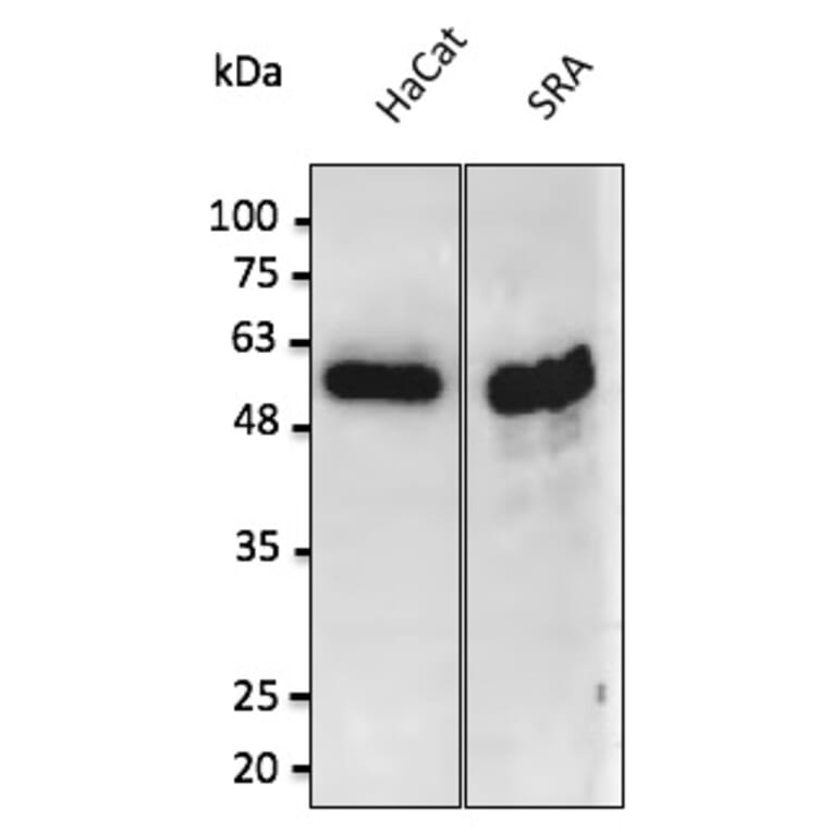 Western Blot - Anti-p53 Antibody (AB0154) - Antibodies.com