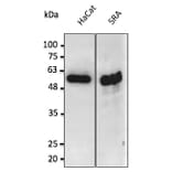 Western Blot - Anti-p53 Antibody (AB0154) - Antibodies.com