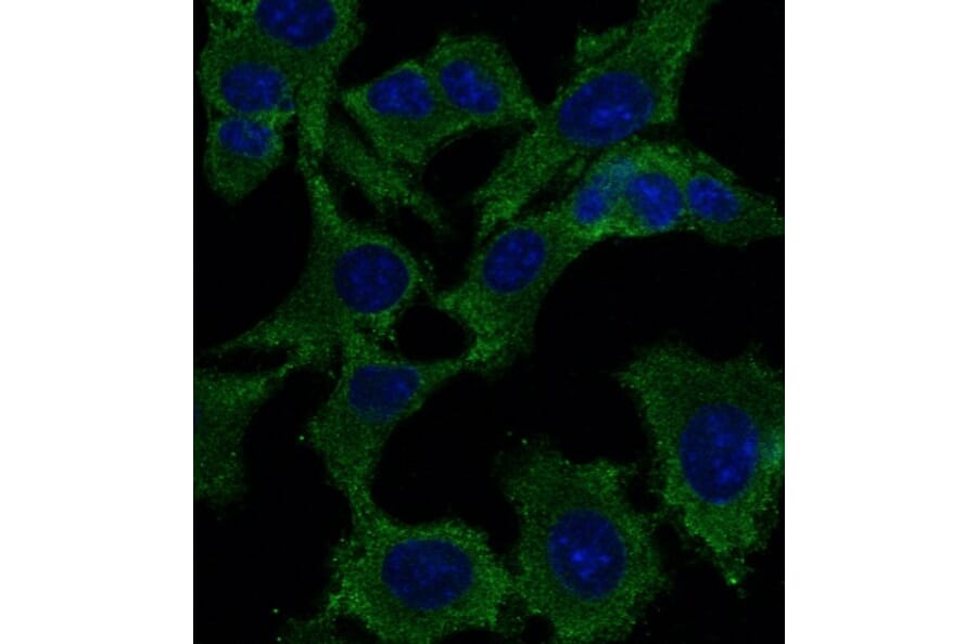 Immunoflouroscence - Anti-p53 Antibody (AB0154) - Antibodies.com