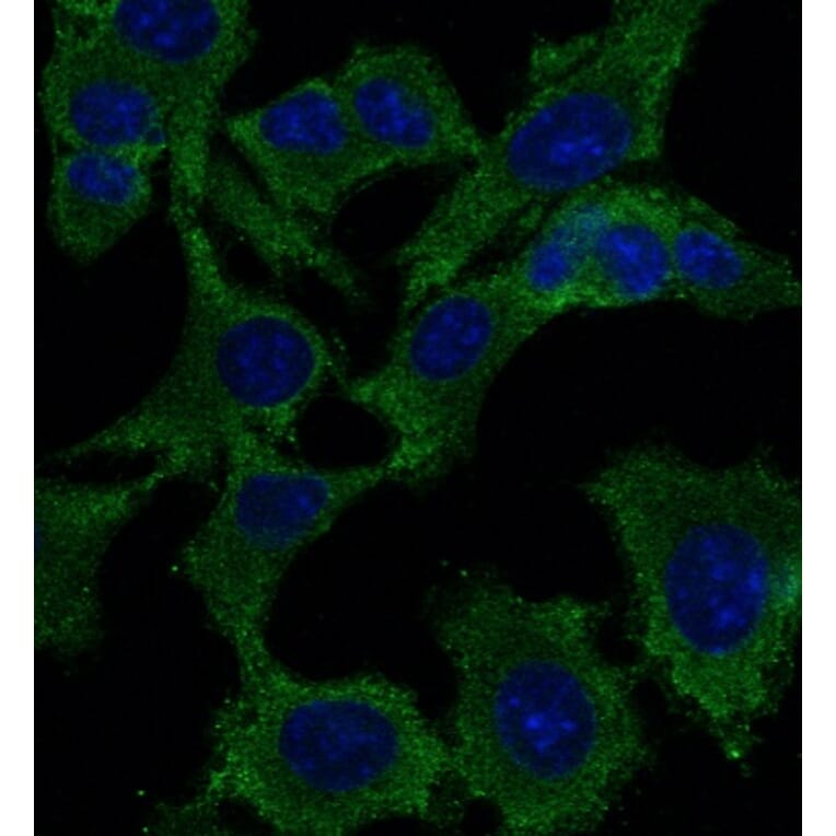 Immunoflouroscence - Anti-p53 Antibody (AB0154) - Antibodies.com