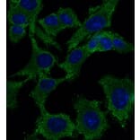 Immunoflouroscence - Anti-p53 Antibody (AB0154) - Antibodies.com