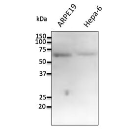 Western Blot - Anti-FTCD Antibody (AB0160) - Antibodies.com