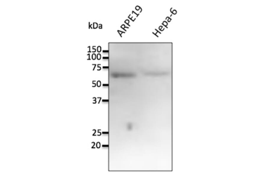 Western Blot - Anti-FTCD Antibody (AB0160) - Antibodies.com