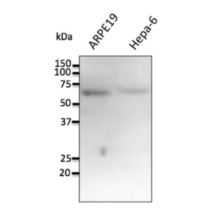 Western Blot - Anti-FTCD Antibody (AB0160) - Antibodies.com
