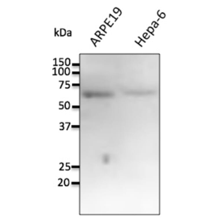 Western Blot - Anti-FTCD Antibody (AB0160) - Antibodies.com