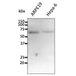 Western Blot - Anti-FTCD Antibody (AB0160) - Antibodies.com