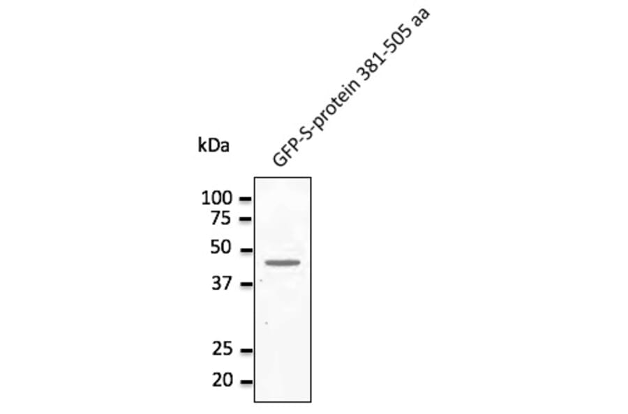 Western Blot - Anti-MERSC-CoV Spike Protein Antibody (AB0161) - Antibodies.com