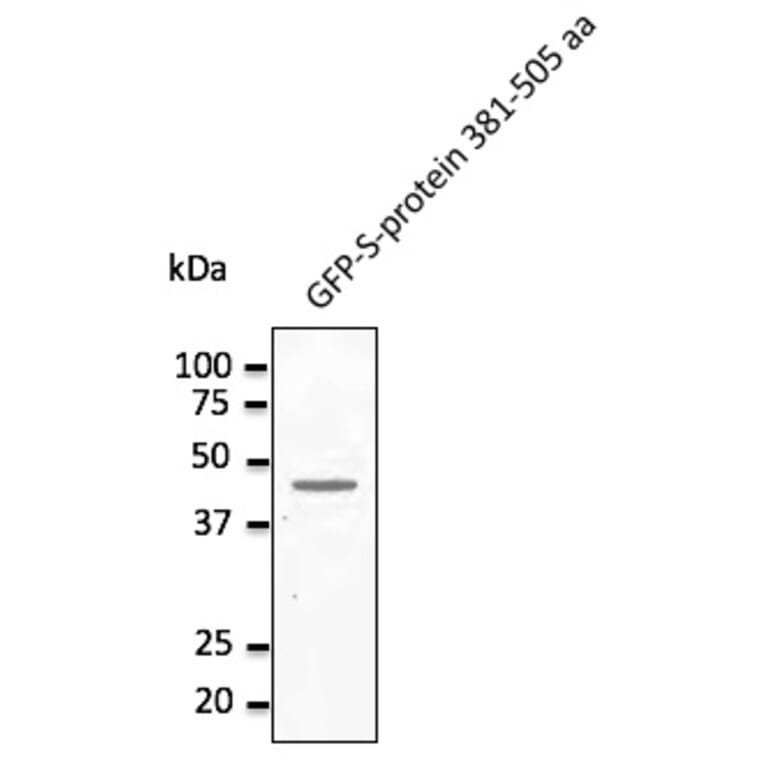 Western Blot - Anti-MERSC-CoV Spike Protein Antibody (AB0161) - Antibodies.com