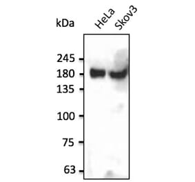 Western Blot - Anti-INSR Antibody (AB0162) - Antibodies.com