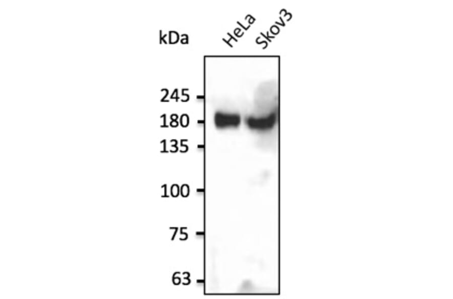Western Blot - Anti-INSR Antibody (AB0162) - Antibodies.com