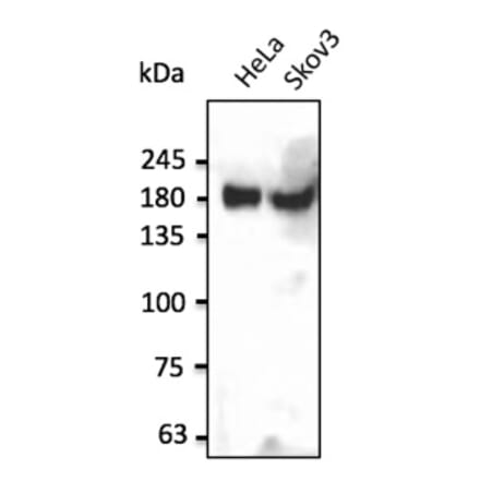 Western Blot - Anti-INSR Antibody (AB0162) - Antibodies.com