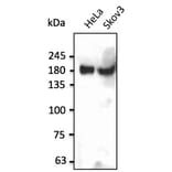 Western Blot - Anti-INSR Antibody (AB0162) - Antibodies.com