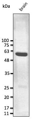 Brain lysate detected with Anti-GFAP Antibody at a 1:2,500 dilution. Lysate at 50µg and rabbit anti-goat IgG antibody (HRP) at a 1:10,000 dilution.