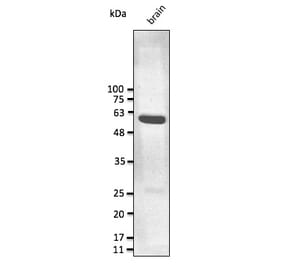 Western Blot - Anti-GFAP Antibody (AB0165) - Antibodies.com