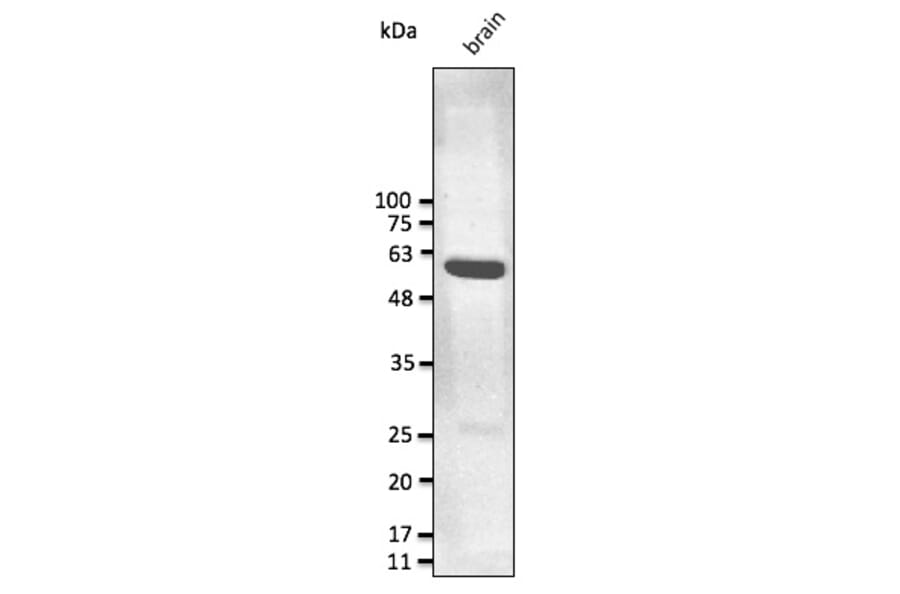 Western Blot - Anti-GFAP Antibody (AB0165) - Antibodies.com