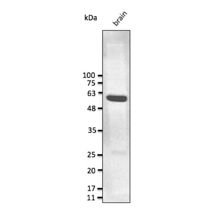 Western Blot - Anti-GFAP Antibody (AB0165) - Antibodies.com