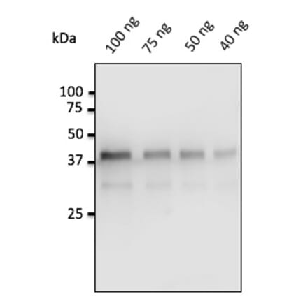 Western Blot - Anti-Pepsin Antibody (AB0197) - Antibodies.com